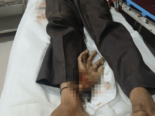 लुधियाना हादसे के बाद बचाव कर्म और घायल की कहानी
